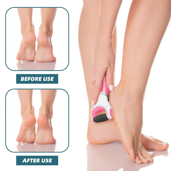 Electric Foot Care Machine - Pedicure Callus Remover for Smooth, Soft Feet