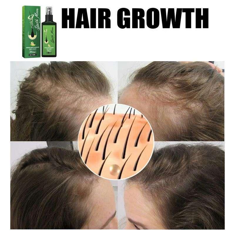 GrowthPlus Nourishing Ginger Spray