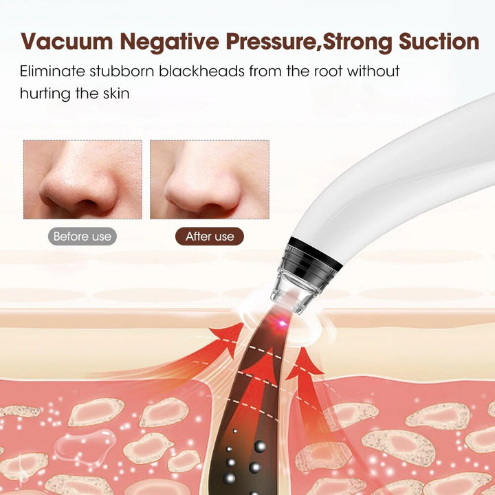 Multi-Functional Electric Blackhead Remover Vacuum with Customizable Suction & Interchangeable Heads