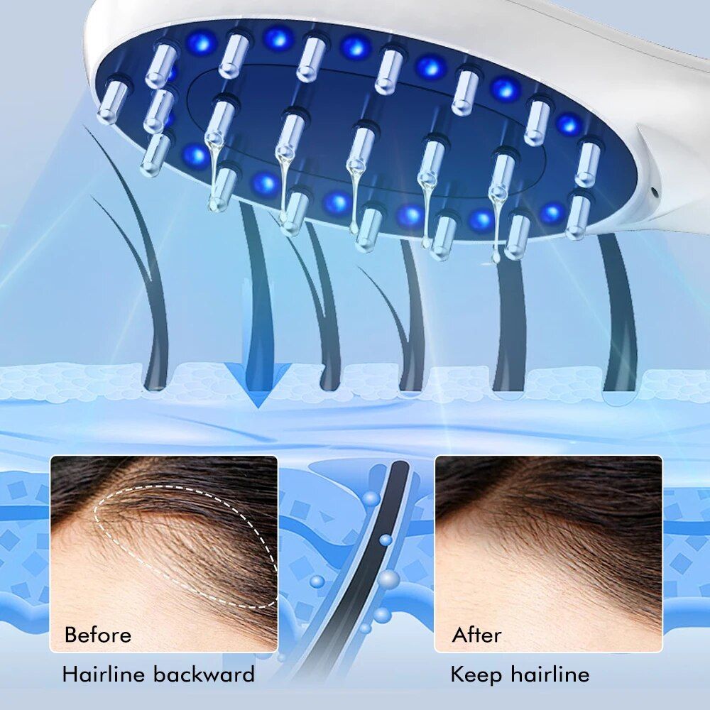 Electric Hair Growth and Scalp Health Massage Comb with Red/Blue Light Therapy
