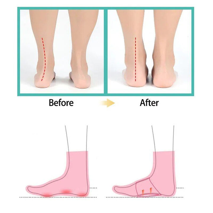 Ultimate Comfort Foot Arch Support Insoles - Orthopedic Pad for Flat Feet & Plantar Fasciitis Relief