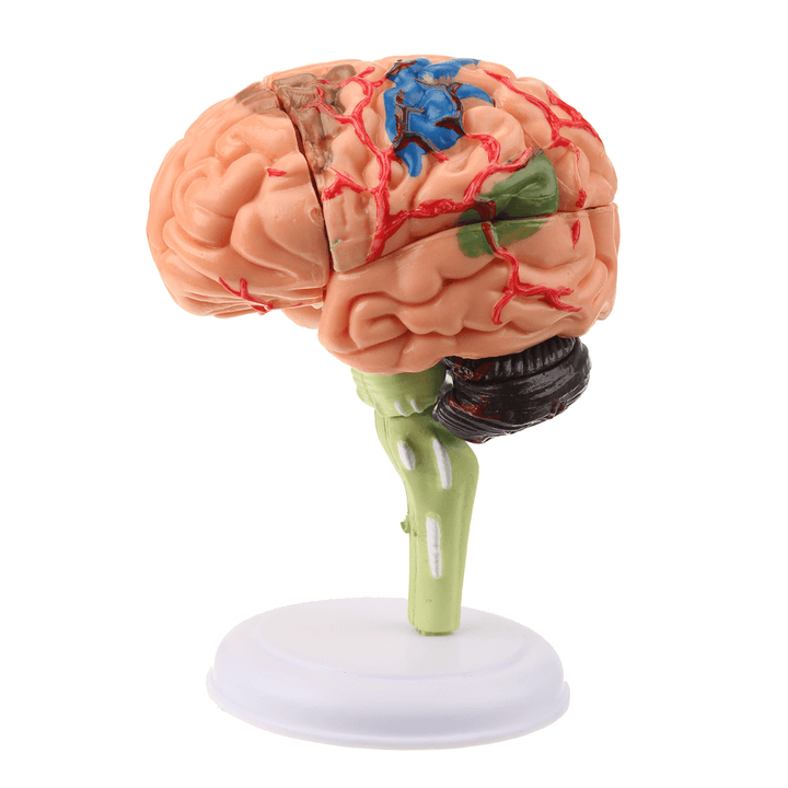 Human Brain Medical Model 4D Disassembled Anatomical School Educational Teaching Tool - MRSLM