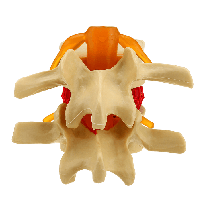 Medical Lumbar Vertebrae Model Props Anatomical Spine Herniation Teaching Tool - MRSLM